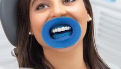 mouth prop mouth prop blue/white
