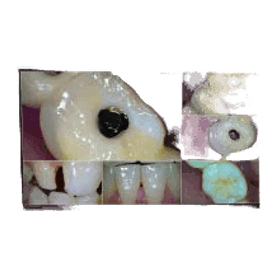 Intraoral Camera FD-CF988