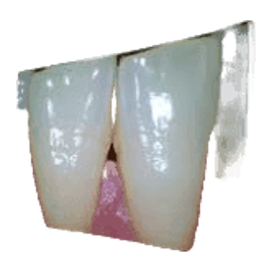 Intraoral Camera FD-M-988A